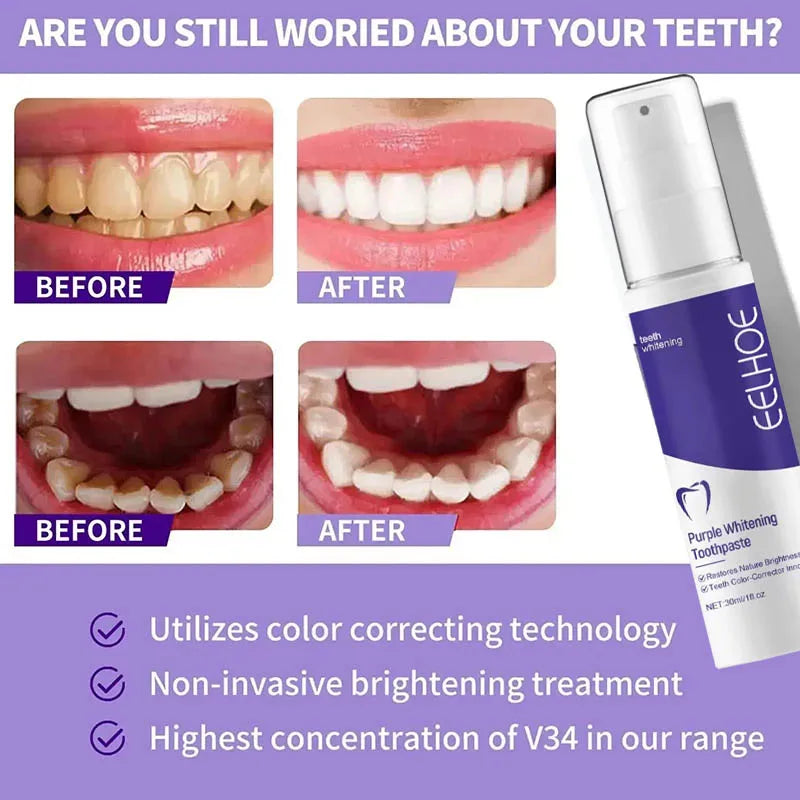 Whitening toothpaste, fresh breath and cleaning care.
Give your smile a brighter glow.